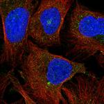 GPR162 Polyclonal Antibody