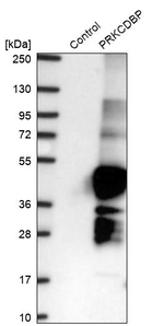 PRKCDBP Antibody in Western Blot (WB)