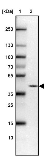 PRKCDBP Antibody in Western Blot (WB)