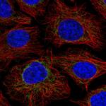 NDUFS2 Antibody in Immunocytochemistry (ICC/IF)