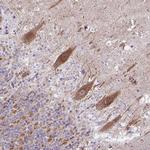 NDUFS2 Antibody in Immunohistochemistry (Paraffin) (IHC (P))
