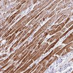 NDUFS2 Antibody in Immunohistochemistry (Paraffin) (IHC (P))