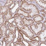 NDUFS2 Antibody in Immunohistochemistry (Paraffin) (IHC (P))