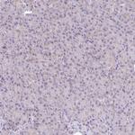 NDUFS2 Antibody in Immunohistochemistry (Paraffin) (IHC (P))