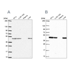 NDUFS2 Antibody in Western Blot (WB)