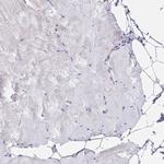 AP2 gamma Antibody in Immunohistochemistry (Paraffin) (IHC (P))