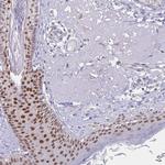 AP2 gamma Antibody in Immunohistochemistry (Paraffin) (IHC (P))