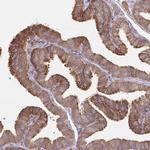 GRF-1 Antibody in Immunohistochemistry (Paraffin) (IHC (P))