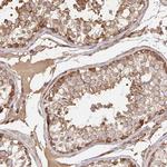 GRF-1 Polyclonal Antibody