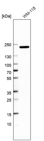 GRF-1 Antibody in Western Blot (WB)