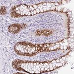 CDX1 Antibody in Immunohistochemistry (Paraffin) (IHC (P))