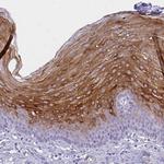 Involucrin Antibody in Immunohistochemistry (Paraffin) (IHC (P))