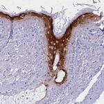 Involucrin Antibody in Immunohistochemistry (Paraffin) (IHC (P))