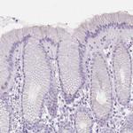 Involucrin Antibody in Immunohistochemistry (Paraffin) (IHC (P))