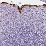 Involucrin Antibody in Immunohistochemistry (Paraffin) (IHC (P))