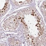 TCFL5 Antibody in Immunohistochemistry (Paraffin) (IHC (P))