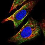 FRAT1 Polyclonal Antibody