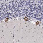 EEF1G Antibody in Immunohistochemistry (Paraffin) (IHC (P))