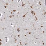 EEF1G Antibody in Immunohistochemistry (Paraffin) (IHC (P))