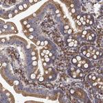 EEF1G Antibody in Immunohistochemistry (Paraffin) (IHC (P))