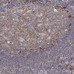 EEF1G Antibody in Immunohistochemistry (Paraffin) (IHC (P))