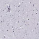 C16orf59 Antibody in Immunohistochemistry (Paraffin) (IHC (P))