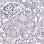 C16orf59 Antibody in Immunohistochemistry (Paraffin) (IHC (P))