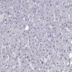 C16orf59 Antibody in Immunohistochemistry (Paraffin) (IHC (P))