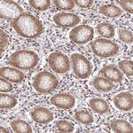 PSMA4 Antibody in Immunohistochemistry (Paraffin) (IHC (P))