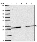 PSMA4 Antibody in Western Blot (WB)