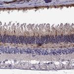 GCAP2 Polyclonal Antibody
