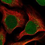 RRAGC Polyclonal Antibody