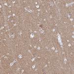 PACSIN1 Antibody in Immunohistochemistry (Paraffin) (IHC (P))