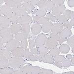 PACSIN1 Antibody in Immunohistochemistry (Paraffin) (IHC (P))