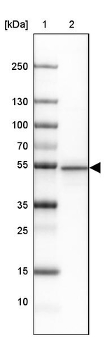 PACSIN1 Antibody in Western Blot (WB)