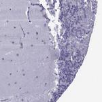 TRIM46 Antibody in Immunohistochemistry (Paraffin) (IHC (P))