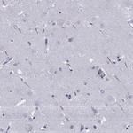 TRIM46 Polyclonal Antibody