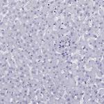 TRIM46 Antibody in Immunohistochemistry (Paraffin) (IHC (P))