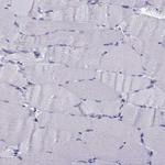 TRIM46 Antibody in Immunohistochemistry (Paraffin) (IHC (P))