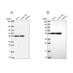 GRWD1 Antibody in Western Blot (WB)