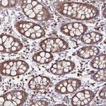 Thioredoxin 1 Antibody in Immunohistochemistry (Paraffin) (IHC (P))