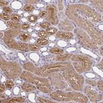 Thioredoxin 1 Antibody in Immunohistochemistry (Paraffin) (IHC (P))
