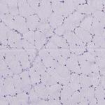 Thioredoxin 1 Antibody in Immunohistochemistry (Paraffin) (IHC (P))