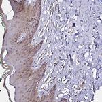Thioredoxin 1 Antibody in Immunohistochemistry (Paraffin) (IHC (P))