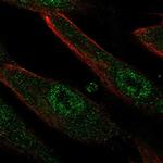 GARP Polyclonal Antibody