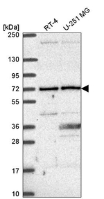 UTP6 Antibody in Western Blot (WB)