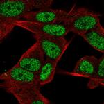 JMJD2D Polyclonal Antibody