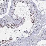 JMJD2D Antibody in Immunohistochemistry (Paraffin) (IHC (P))