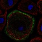 TNNI2 Polyclonal Antibody