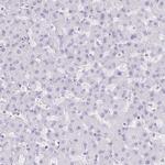 TNNI2 Antibody in Immunohistochemistry (Paraffin) (IHC (P))